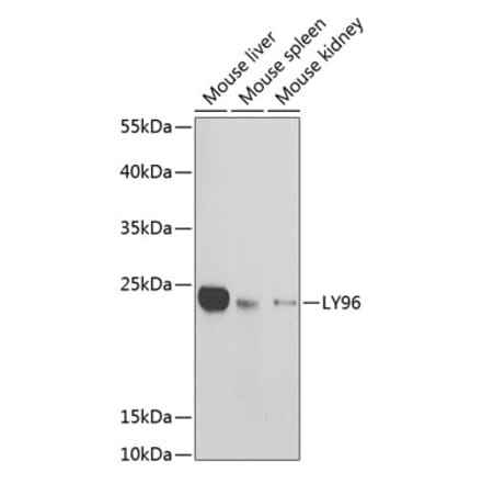 Western Blot - Anti-MD2 Antibody (A13712) - Antibodies.com