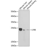 Western Blot - Anti-MD2 Antibody (A13712) - Antibodies.com