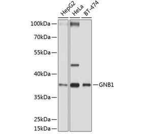 Western Blot - Anti-GNB1 Antibody (A13713) - Antibodies.com