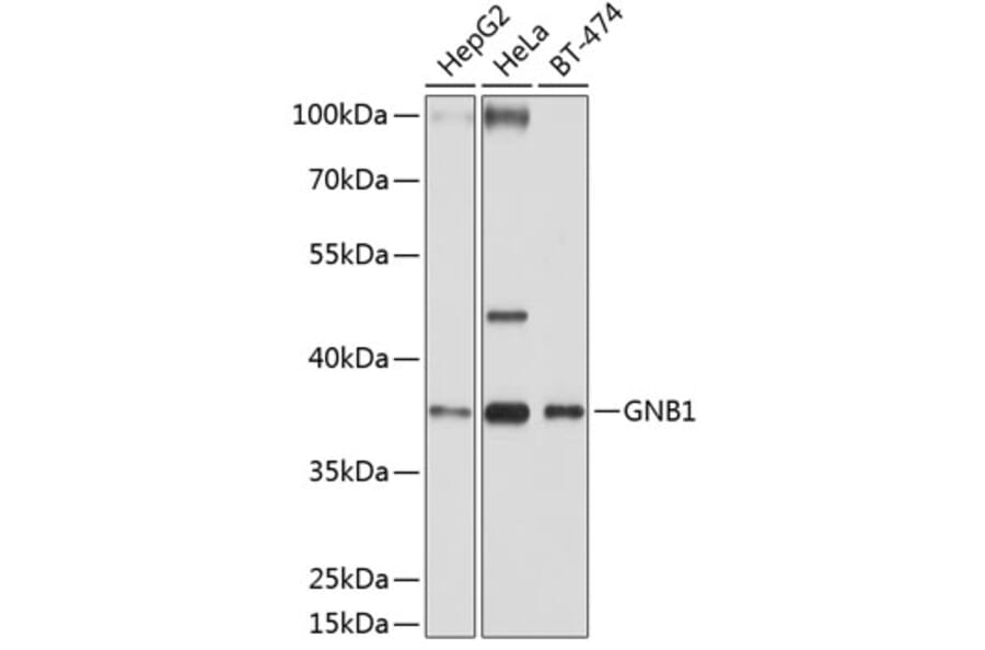 Western Blot - Anti-GNB1 Antibody (A13713) - Antibodies.com