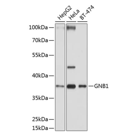 Western Blot - Anti-GNB1 Antibody (A13713) - Antibodies.com