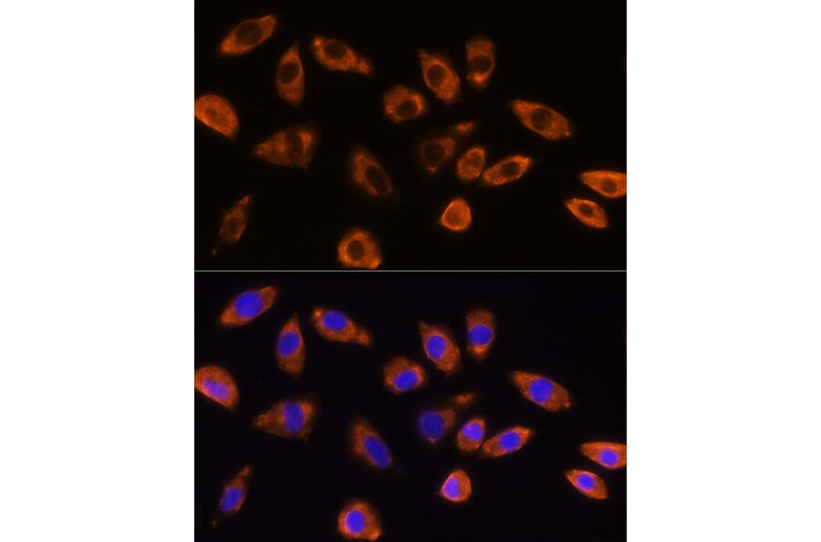 Immunofluorescence - Anti-GNB1 Antibody (A13713) - Antibodies.com