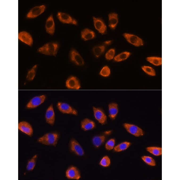 Immunofluorescence - Anti-GNB1 Antibody (A13713) - Antibodies.com