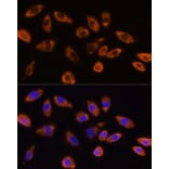 Immunofluorescence - Anti-GNB1 Antibody (A13713) - Antibodies.com