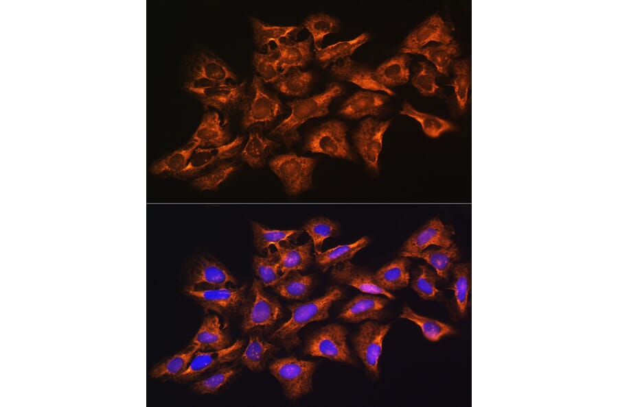 Immunofluorescence - Anti-GNB1 Antibody (A13713) - Antibodies.com