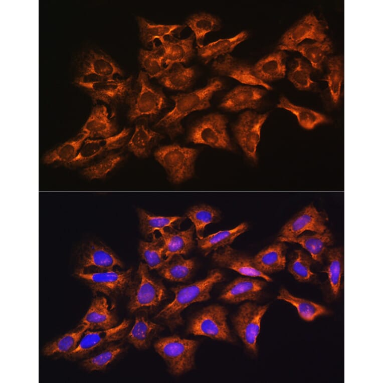 Immunofluorescence - Anti-GNB1 Antibody (A13713) - Antibodies.com