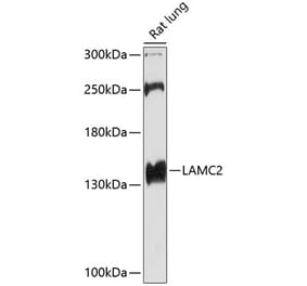 Western Blot - Anti-LAMC2 Antibody (A13714) - Antibodies.com
