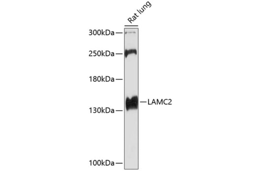 Western Blot - Anti-LAMC2 Antibody (A13714) - Antibodies.com