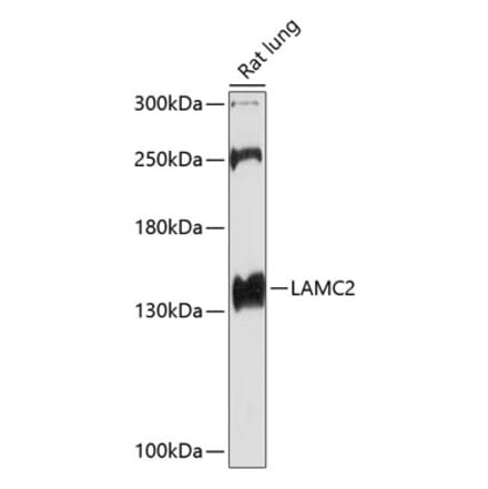 Western Blot - Anti-LAMC2 Antibody (A13714) - Antibodies.com