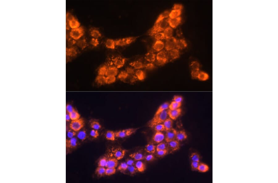Immunofluorescence - Anti-LAMC2 Antibody (A13714) - Antibodies.com