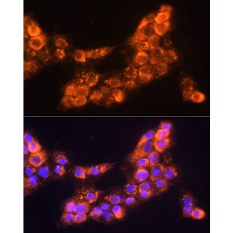 Immunofluorescence - Anti-LAMC2 Antibody (A13714) - Antibodies.com