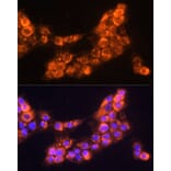 Immunofluorescence - Anti-LAMC2 Antibody (A13714) - Antibodies.com