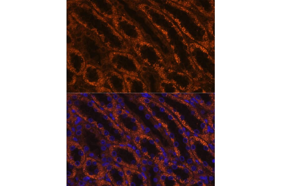 Immunofluorescence - Anti-LAMC2 Antibody (A13714) - Antibodies.com