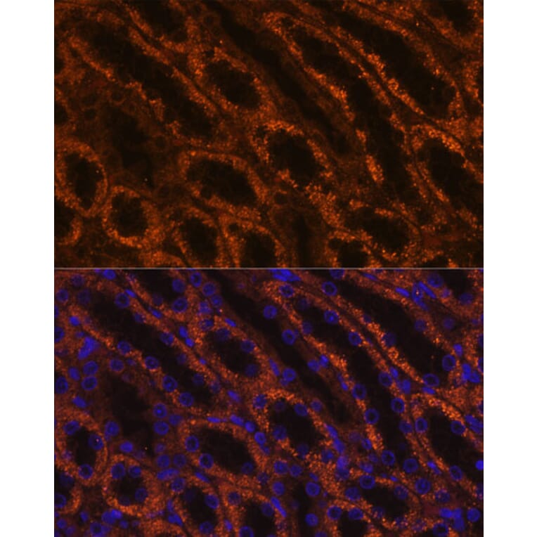 Immunofluorescence - Anti-LAMC2 Antibody (A13714) - Antibodies.com