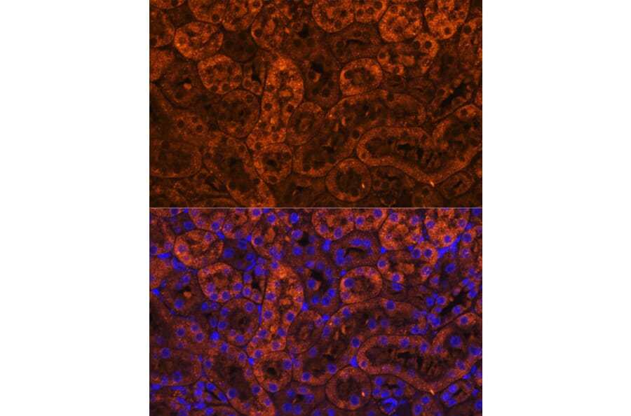 Immunofluorescence - Anti-LAMC2 Antibody (A13714) - Antibodies.com