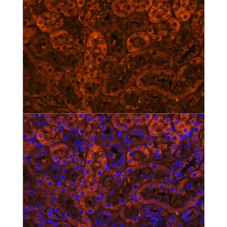Immunofluorescence - Anti-LAMC2 Antibody (A13714) - Antibodies.com