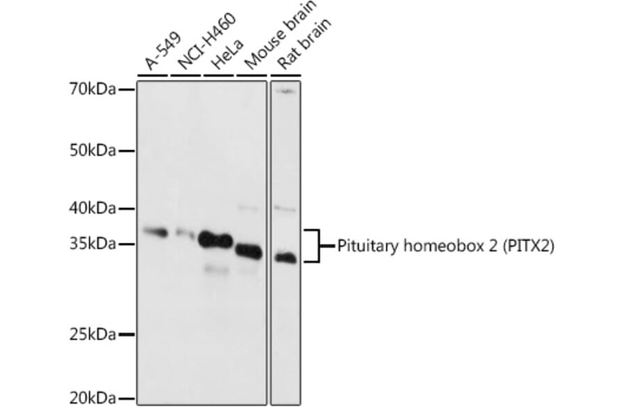 Western Blot - Anti-PITX2/RGS Antibody (A13715) - Antibodies.com
