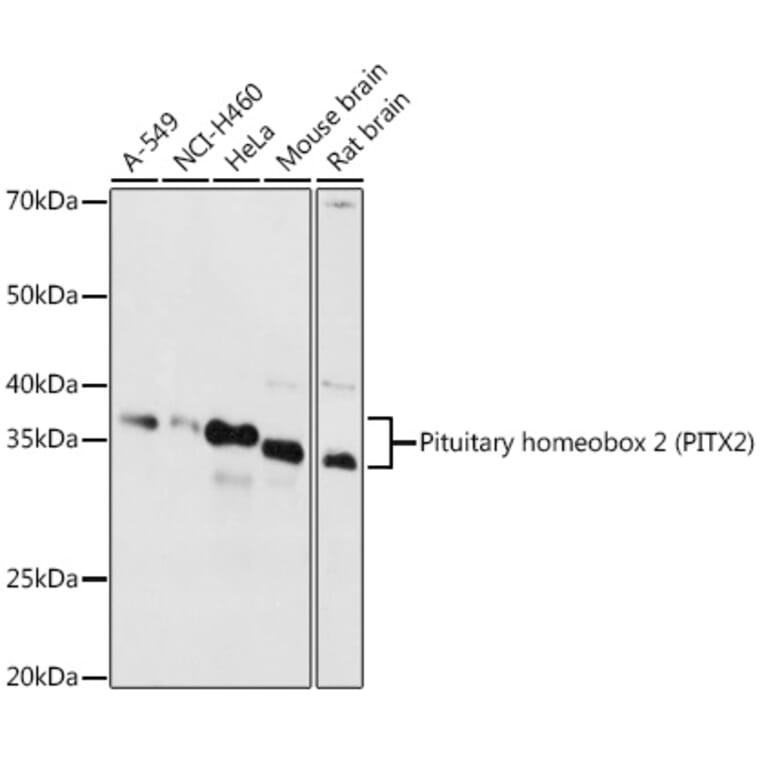 Western Blot - Anti-PITX2/RGS Antibody (A13715) - Antibodies.com