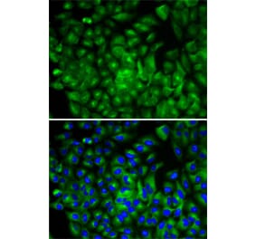 Immunofluorescence - Anti-ATG16L1 Antibody (A13716) - Antibodies.com