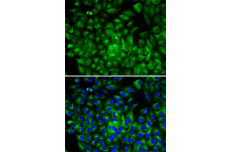 Immunofluorescence - Anti-ATG16L1 Antibody (A13716) - Antibodies.com