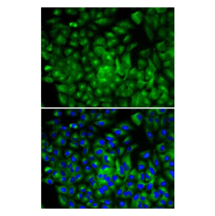 Immunofluorescence - Anti-ATG16L1 Antibody (A13716) - Antibodies.com