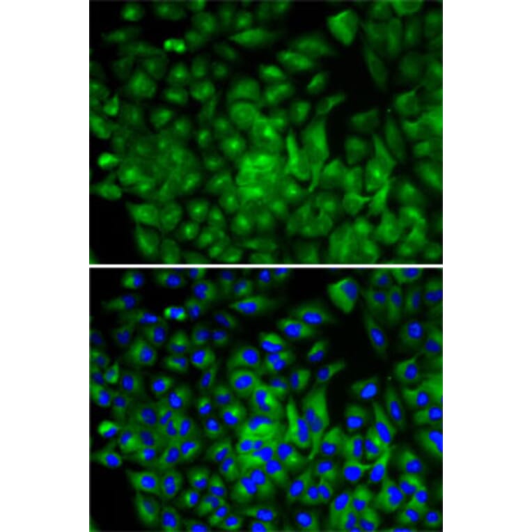 Immunofluorescence - Anti-ATG16L1 Antibody (A13716) - Antibodies.com