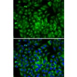 Immunofluorescence - Anti-ATG16L1 Antibody (A13716) - Antibodies.com