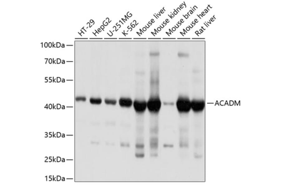 Western Blot - Anti-ACADM/MCAD Antibody (A13717) - Antibodies.com