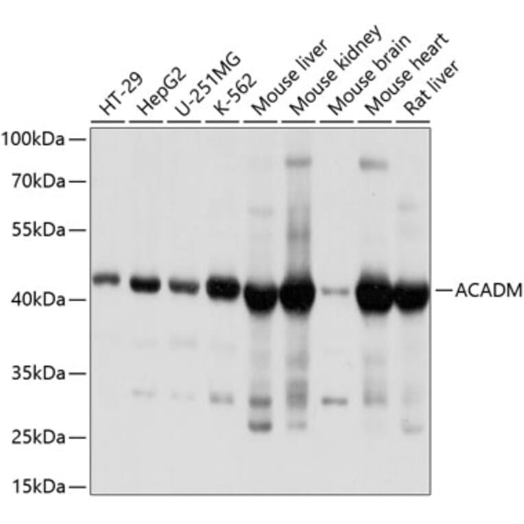 Western Blot - Anti-ACADM/MCAD Antibody (A13717) - Antibodies.com