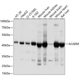 Western Blot - Anti-ACADM/MCAD Antibody (A13717) - Antibodies.com