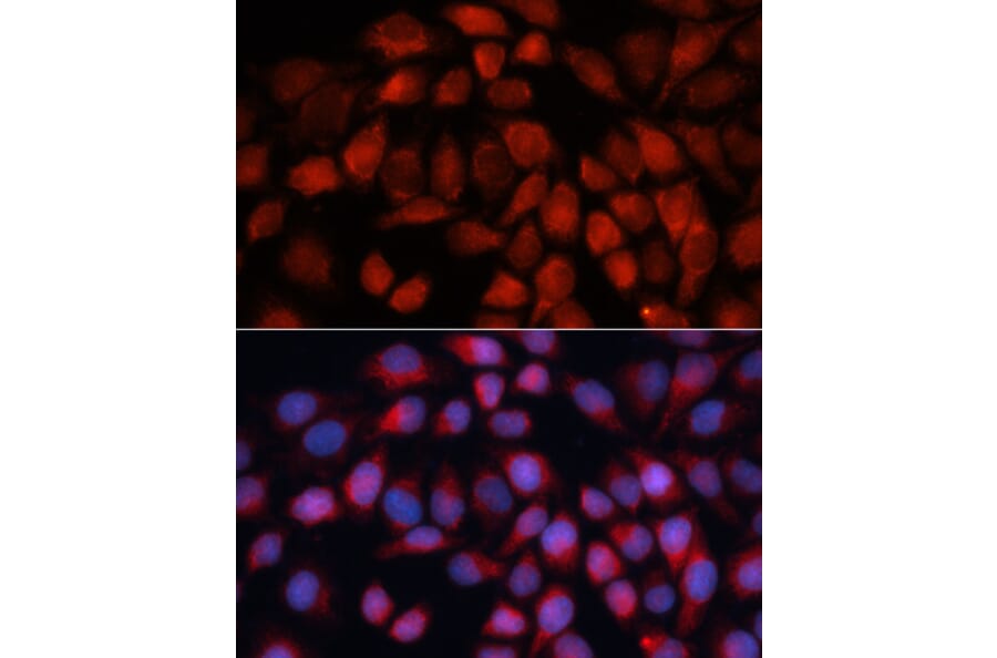 Immunofluorescence - Anti-ACADM/MCAD Antibody (A13717) - Antibodies.com