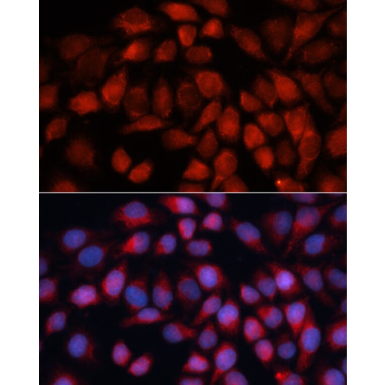Immunofluorescence - Anti-ACADM/MCAD Antibody (A13717) - Antibodies.com