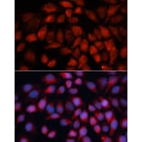 Immunofluorescence - Anti-ACADM/MCAD Antibody (A13717) - Antibodies.com