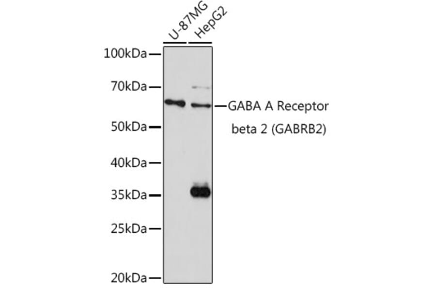 Western Blot - Anti-GABA A Receptor beta 2/GABRB2 Antibody (A13718) - Antibodies.com