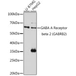 Western Blot - Anti-GABA A Receptor beta 2/GABRB2 Antibody (A13718) - Antibodies.com