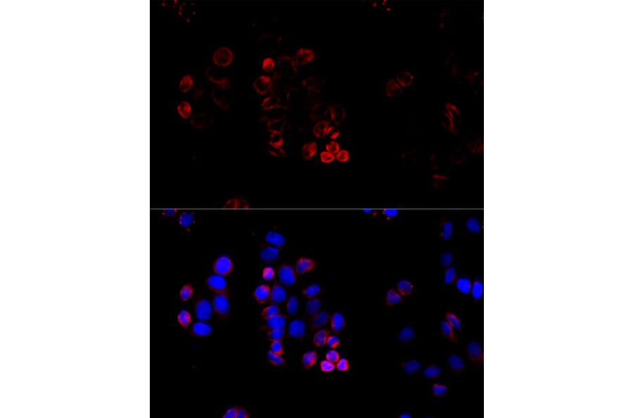 Immunofluorescence - Anti-ABCG8 Antibody (A13719) - Antibodies.com