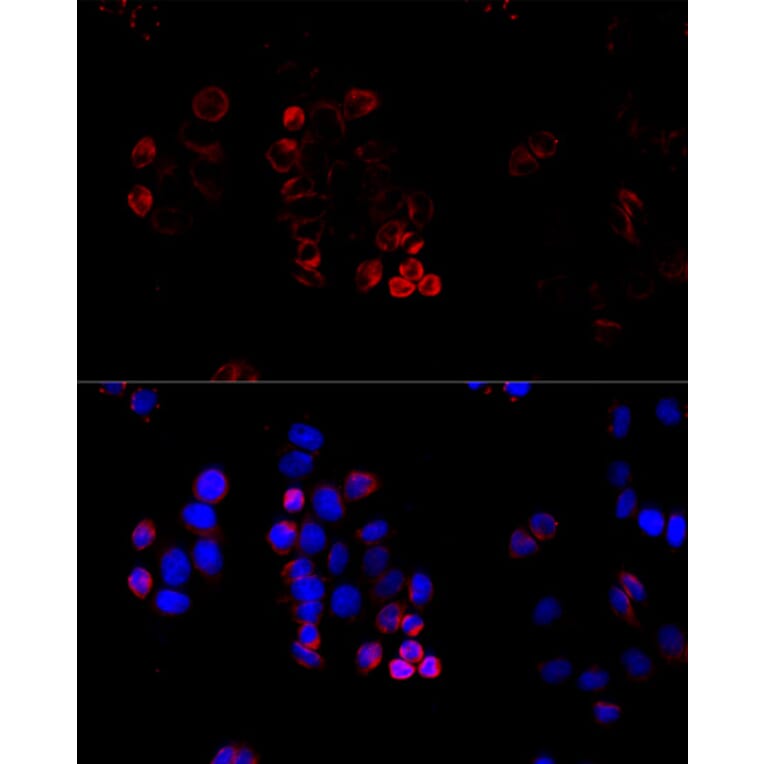 Immunofluorescence - Anti-ABCG8 Antibody (A13719) - Antibodies.com