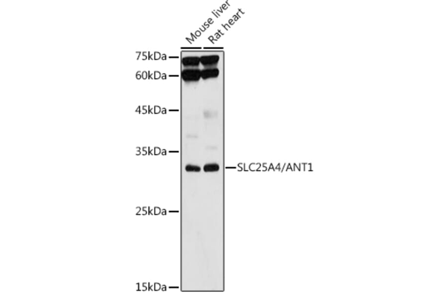 Western Blot - Anti-Adenine Nucleotide Translocator 1/ANT 1 Antibody (A13720) - Antibodies.com