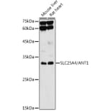 Western Blot - Anti-Adenine Nucleotide Translocator 1/ANT 1 Antibody (A13720) - Antibodies.com