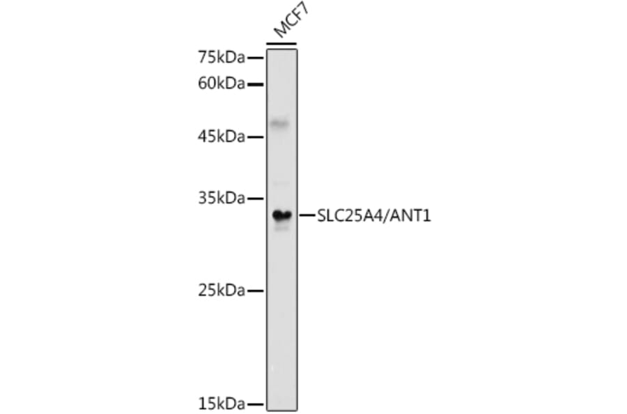 Western Blot - Anti-Adenine Nucleotide Translocator 1/ANT 1 Antibody (A13720) - Antibodies.com