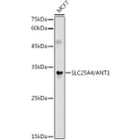 Western Blot - Anti-Adenine Nucleotide Translocator 1/ANT 1 Antibody (A13720) - Antibodies.com