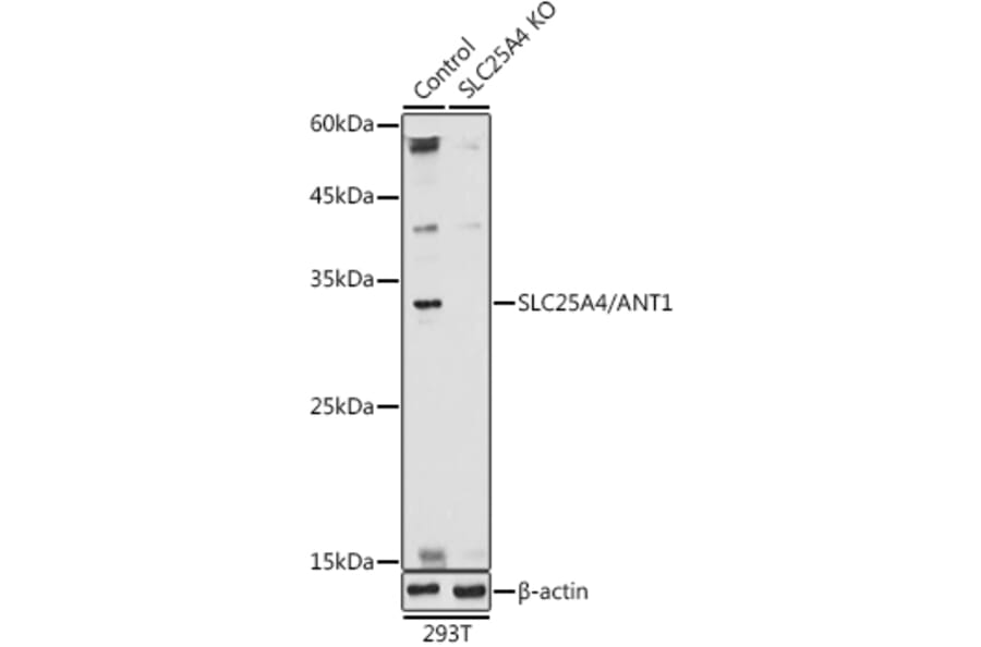 Western Blot - Anti-Adenine Nucleotide Translocator 1/ANT 1 Antibody (A13720) - Antibodies.com
