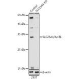 Western Blot - Anti-Adenine Nucleotide Translocator 1/ANT 1 Antibody (A13720) - Antibodies.com