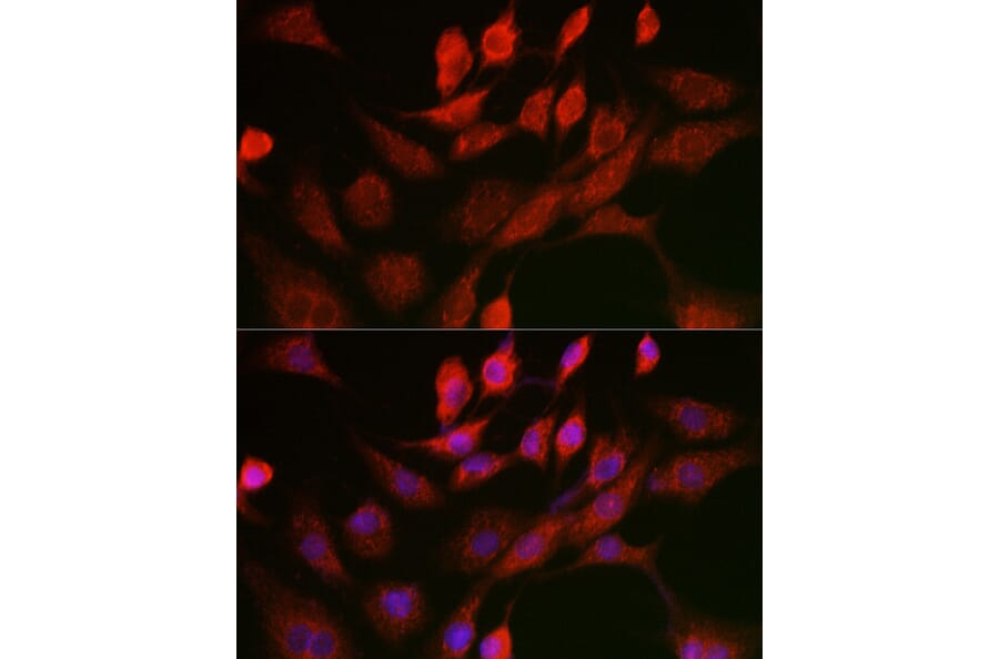 Immunofluorescence - Anti-Adenine Nucleotide Translocator 1/ANT 1 Antibody (A13720) - Antibodies.com