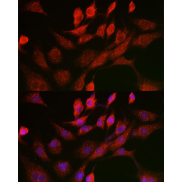 Immunofluorescence - Anti-Adenine Nucleotide Translocator 1/ANT 1 Antibody (A13720) - Antibodies.com