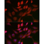 Immunofluorescence - Anti-Adenine Nucleotide Translocator 1/ANT 1 Antibody (A13720) - Antibodies.com