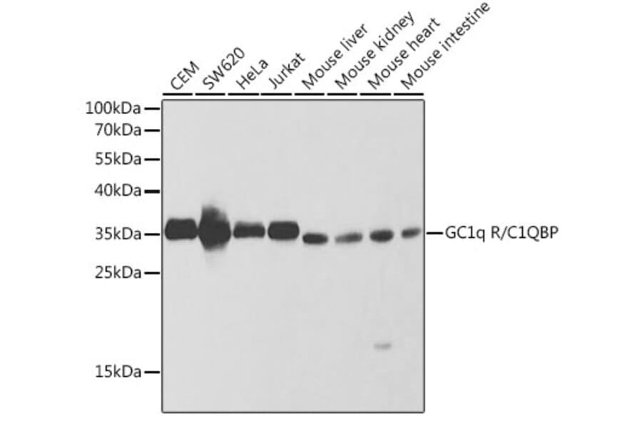 Western Blot - Anti-GC1q R Antibody (A13721) - Antibodies.com