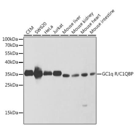 Western Blot - Anti-GC1q R Antibody (A13721) - Antibodies.com