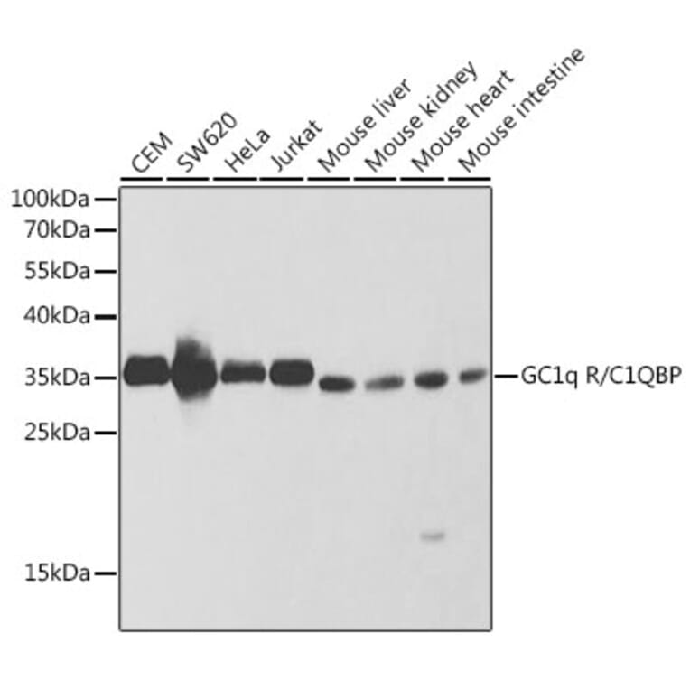 Western Blot - Anti-GC1q R Antibody (A13721) - Antibodies.com