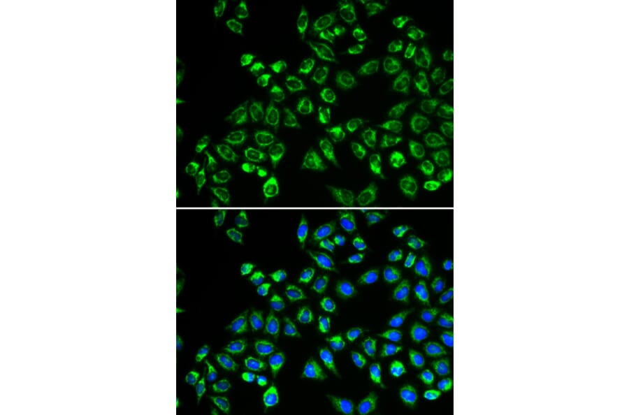 Immunofluorescence - Anti-GC1q R Antibody (A13721) - Antibodies.com